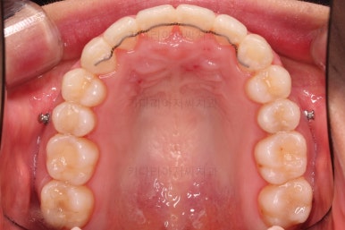 부산교정잘하는치과