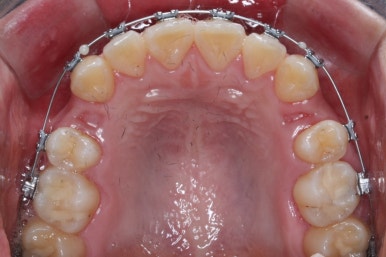 부산교정전문의