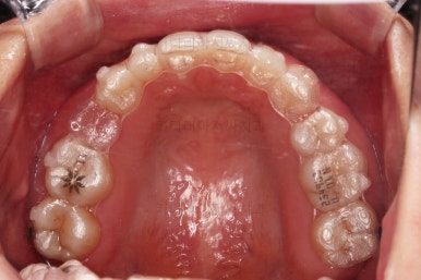 부산인비절라인