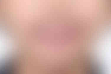 부산어린이반대교합