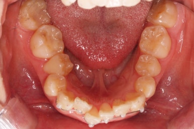 부산무턱교정치과