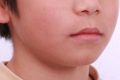 부산어린이교정