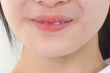 연산동교정치과