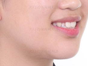 사직동교정치과