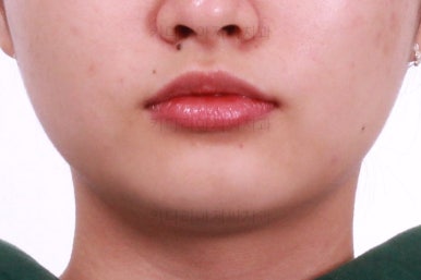 부산치아교정치과