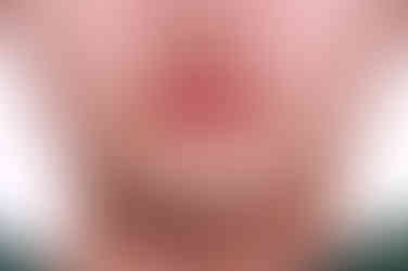 부산치아교정치과