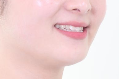 부산교정치과