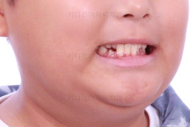 부산어린이교정