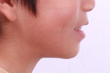 부산어린이교정