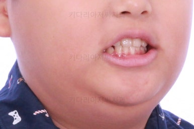 부산어린이교정