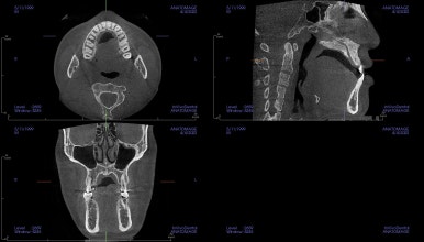 부산긴얼굴긴턱교정