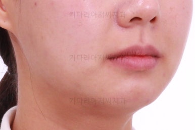 부산치아교정잘하는치과