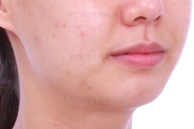 부산치아교정잘하는치과