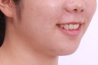 부산교정전문치과
