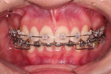 연산동치아교정치과