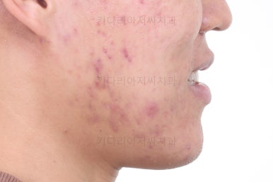 부산교정과전문의