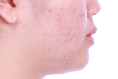 부산치아교정치과