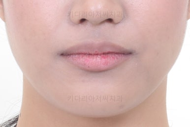 연산동치아교정치과