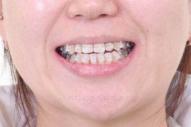 부산연산동치과