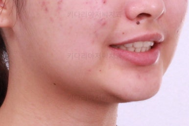 부산치아교정치과