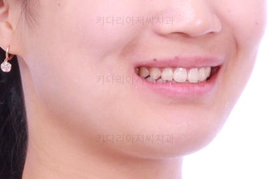 부산치아교정치과