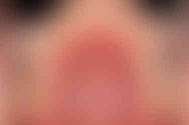 부산치아교정잘하는곳