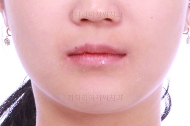 부산치아교정치과