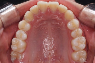 부산치아교정잘하는곳