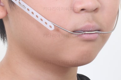 부산어린이돌출입교정