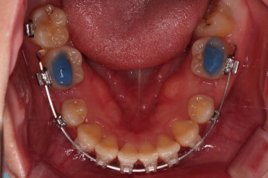 부산연산동교정치과