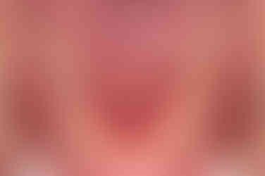 부산치아교정치과