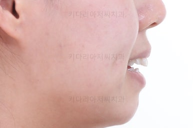부산치아교정잘하는치과