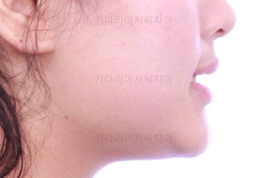 부산교정치과추천