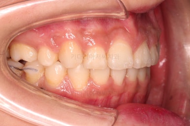 연산동교정치과