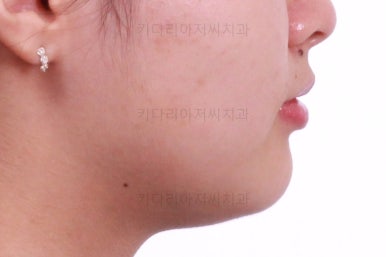 부산치아교정치과