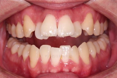 부산인비절라인