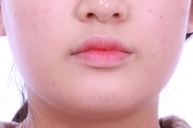 부산교정치과추천