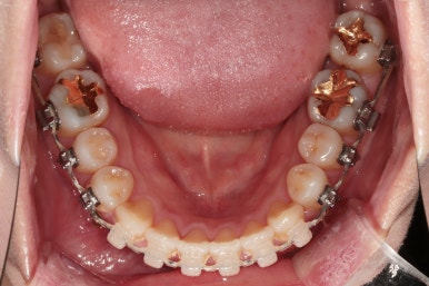 부산연산동치과