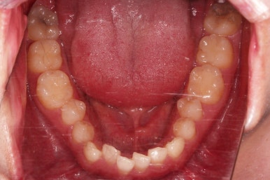 부산긴얼굴긴턱교정