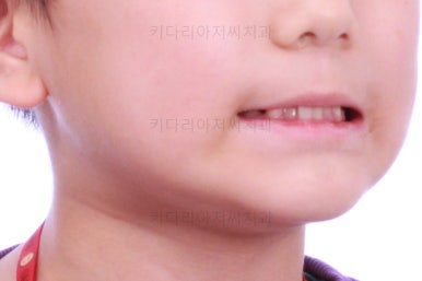 부산어린이교정