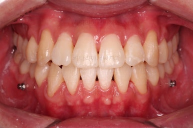 부산인비절라인