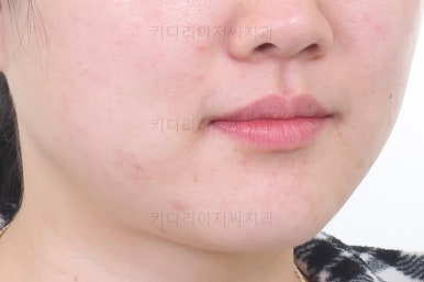 부산인비절라인