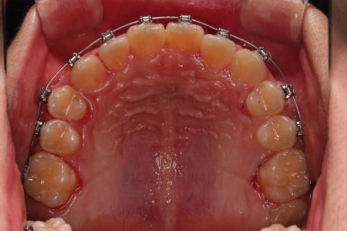 부산청소년교정