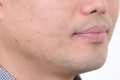 부산교정치과추천