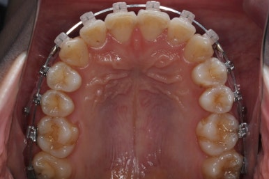 연산동교정치과