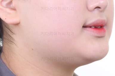 부산교정치과추천