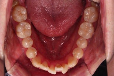 부산인비절라인