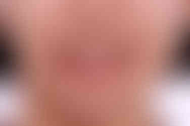 부산연산동교정치과
