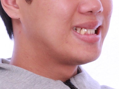 부산교정치과추천