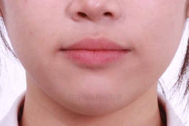 부산치과
